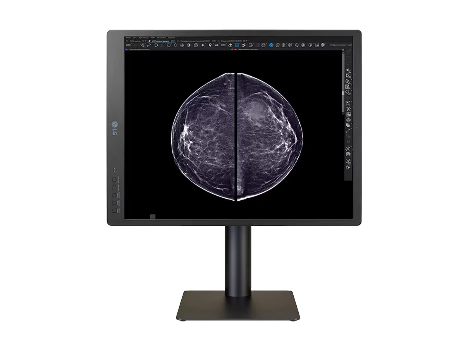 LG 5MP 21" Color Mammography 3D-Tomosynthesis Breast Imaging Display Monitor (21HQ613D)