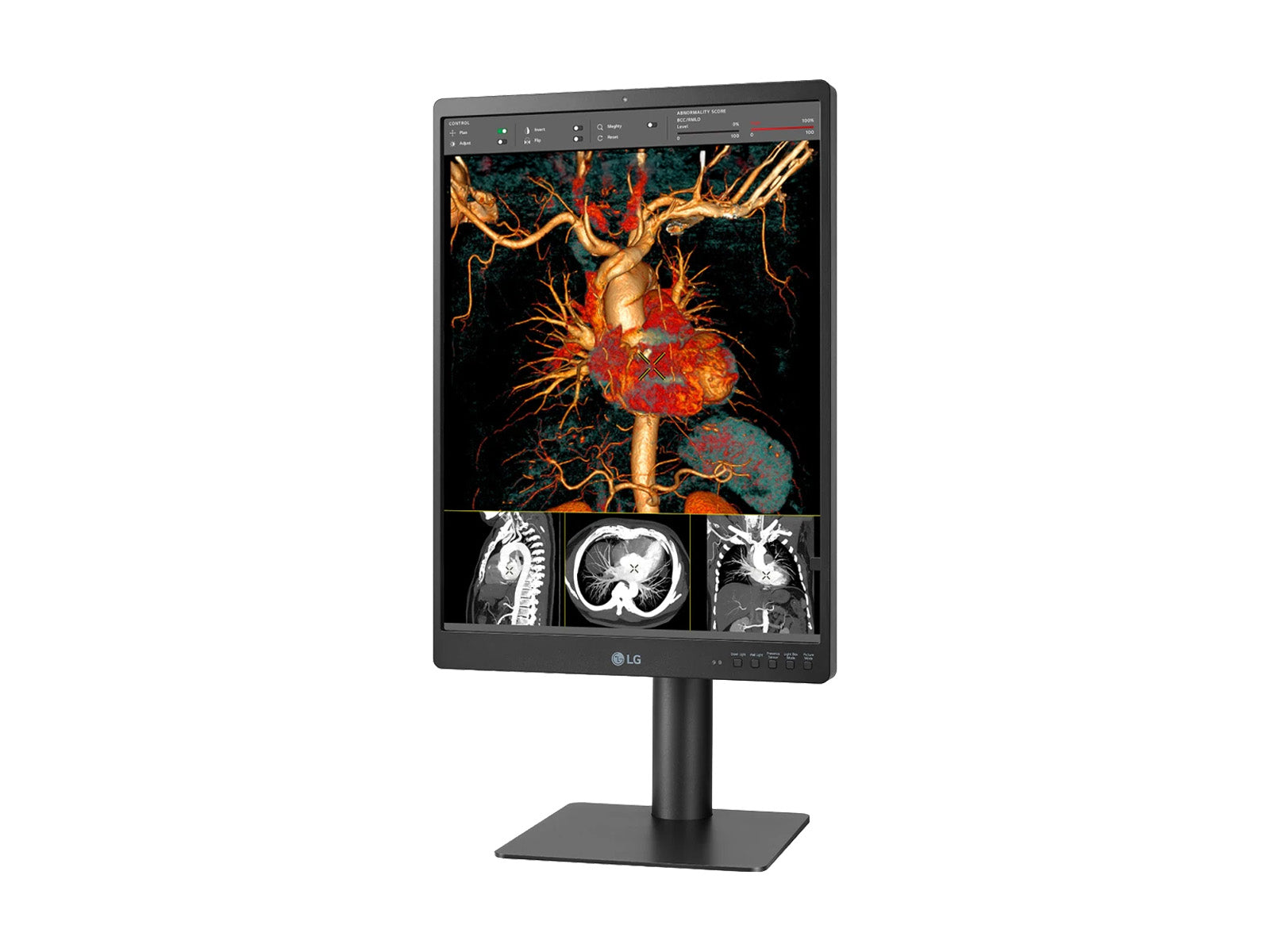 LG 21HQ513D 3MP 21" Color Medical Diagnostic Radiology Display Monitor (21HQ513D)