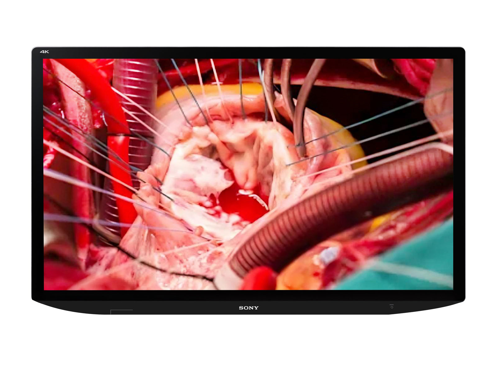 Sony LMD-X310MT 31" LCD 4K 3D/2D Color Surgical Medical Display Monitor (LMD-X310MT)