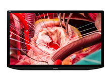 Sony LMD-X310MT LCD di 31 pollici 4K Monitor di Esposizione Medico Chirurgico In 3 D/2o (LMD-X310MT)