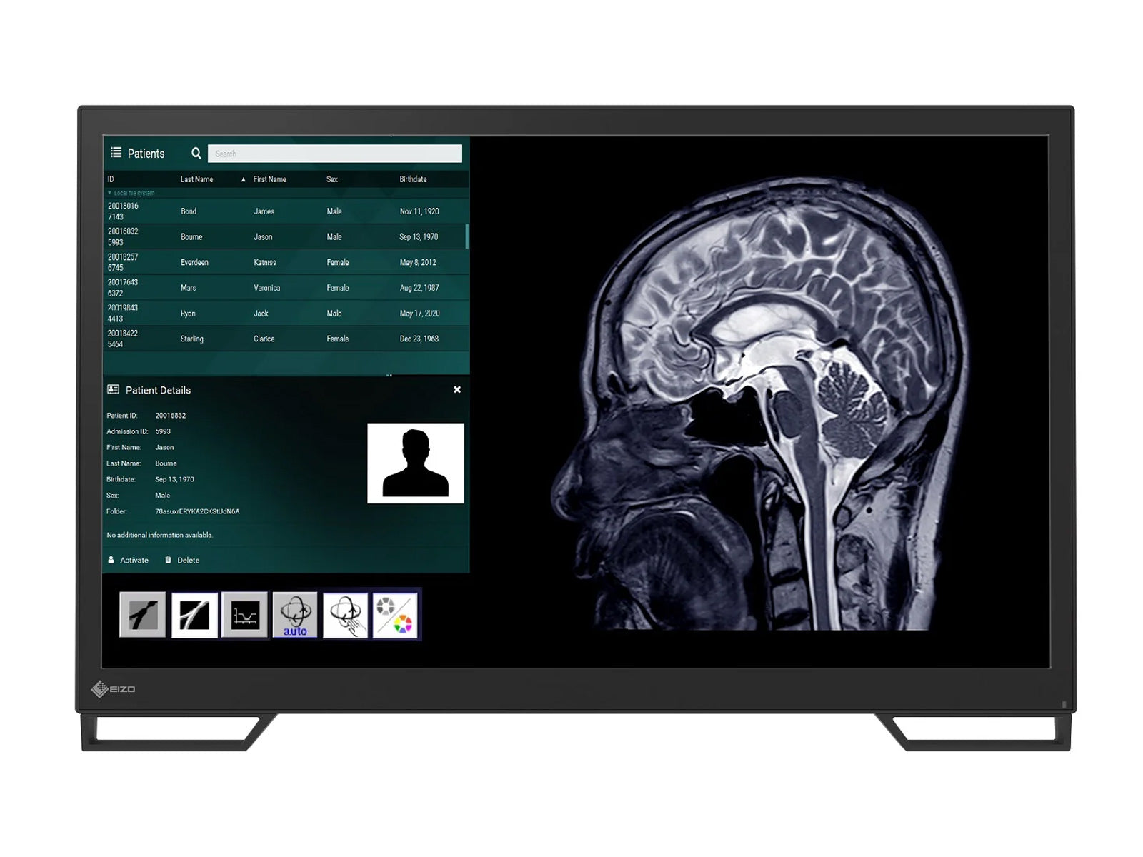 Eizo 23.8″ Surgical Endoscopy Medical Touch Display Monitor (LX2420-T)