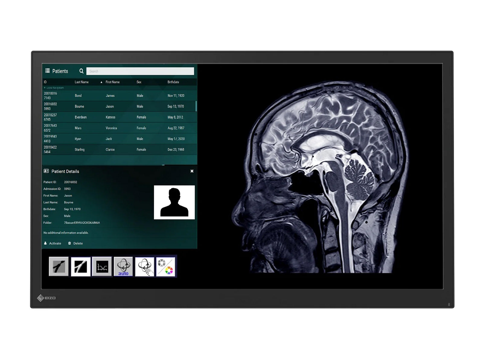 Eizo 23.8″ Surgical Endoscopy Medical Touch Display Monitor (LX2420-T)