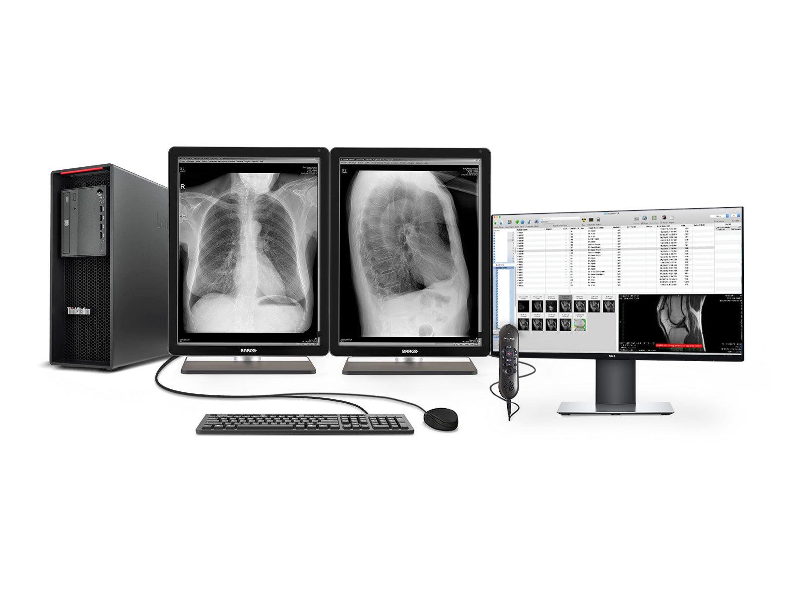 محطة الأشعة العامة PACS كاملة | Barco 3MP شاشات LED ذات تدرج الرمادي | Lenovo محطة العمل | ميكروفون الإملاء | شاشة قائمة العمل (3221Z4R)