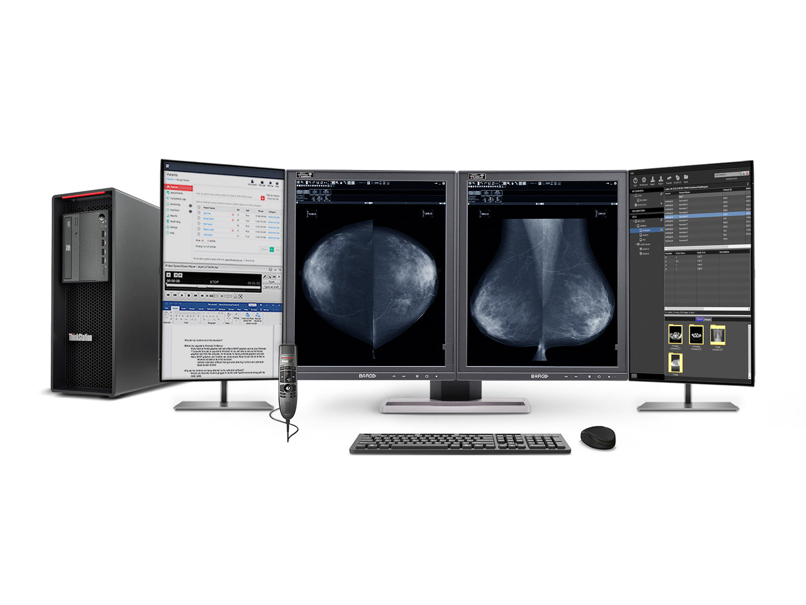 Stazione di lettura mammografica completa | Barco MDMG-5221 5MP Monitor LED in scala di grigio | Lenovo Stazione di lavoro | dettato Mic | monitor di Worklist (5221Z42221)