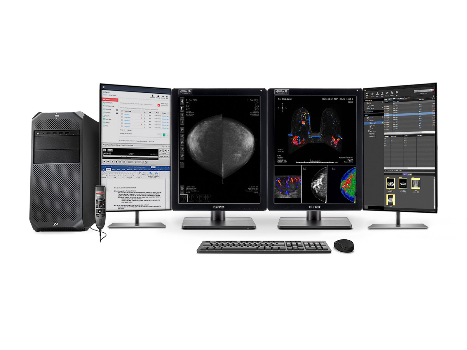 Station de lecture de mammographie complète | Barco 5MP MDNC-6121 Couleurs LED LED | HP Passe de travail | Microphone de dictée (LFH3510) | Moniteurs de liste de travail (61212321R)