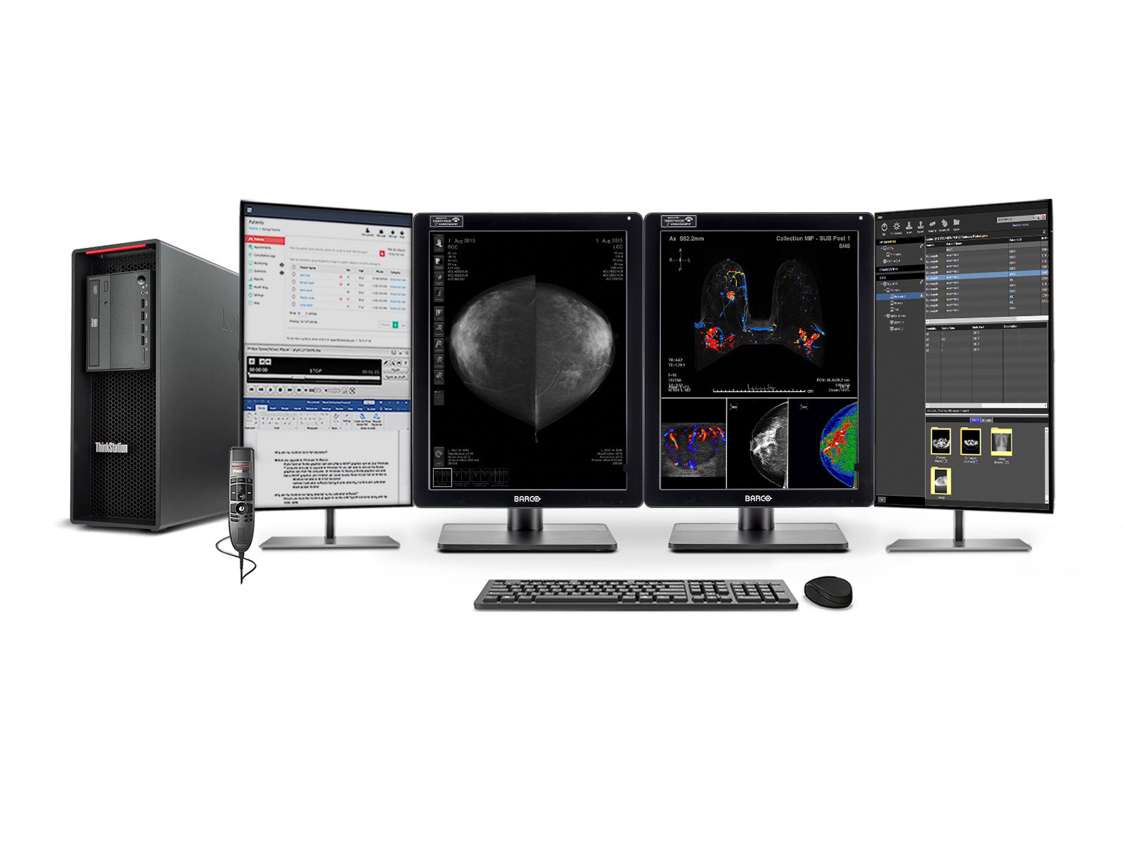 Stazione di lettura mammografica completa | Barco 5MP Monitor LED a colori MDNC-6121 | Lenovo Postazione di lavoro | Microfono di dettatura (LFH3510)| Monitor di lista di lavoro (61212321R) 