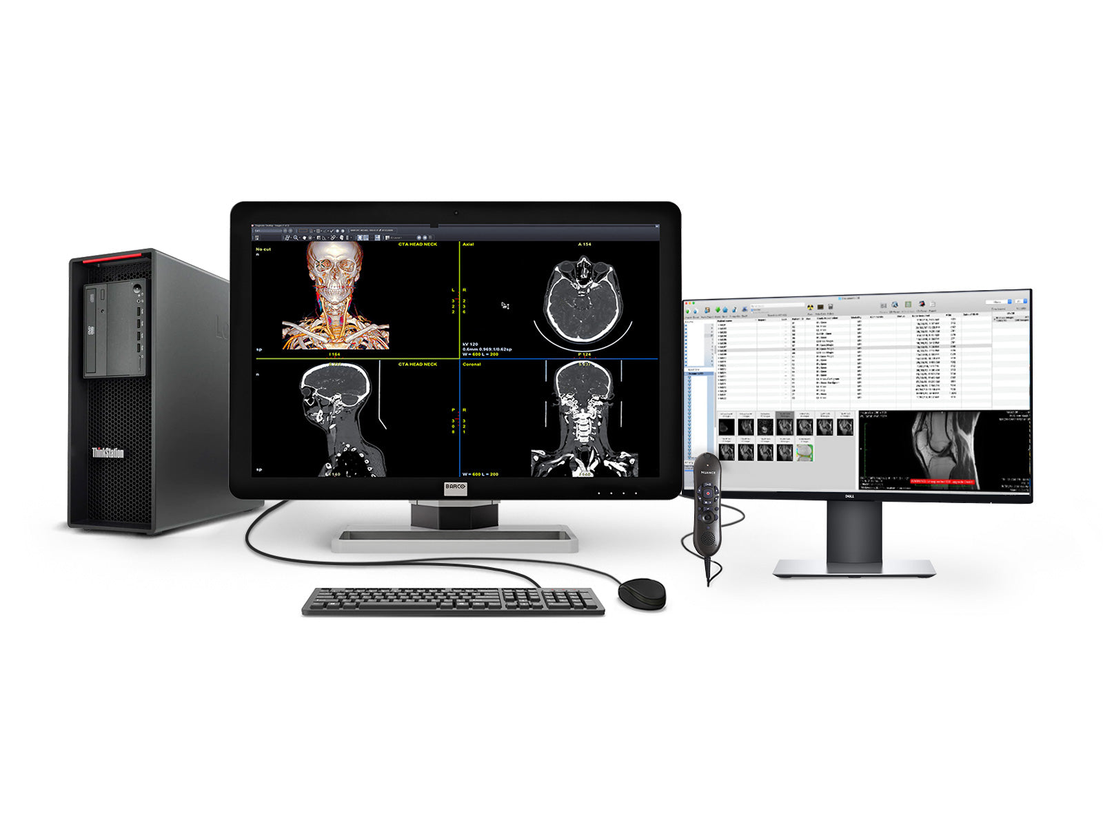 Barco® Nio MDNC-3421 3MP Color LED Radiology PACS Display (K9602861)