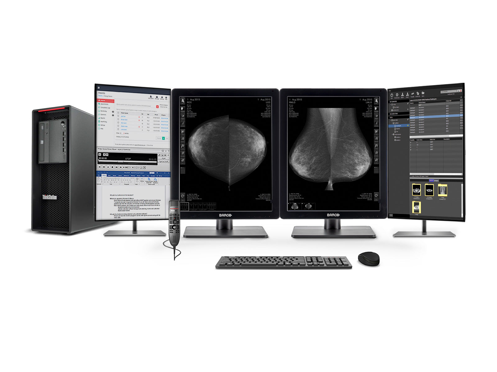 Stazione di Lettura Mammografica Completa | Barco MDNG-5221 5MP Monitor LED in Scala di Grigi | Lenovo Postazione di Lavoro | Microfono di Dettatura | Monitor della Lista di Lavoro (QNG5221Z4R) 