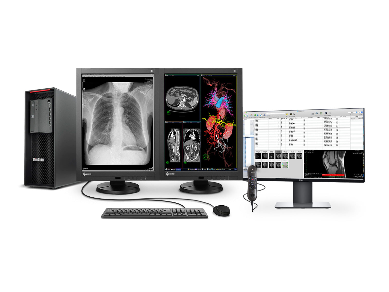 Komplette PACS-Station für allgemeine Radiologie | Eizo 3MP Farbige LED-Anzeigen | Lenovo Arbeitsplatz | Diktiermikrofon | Arbeitsvorratsmonitor (RX340Z4R)