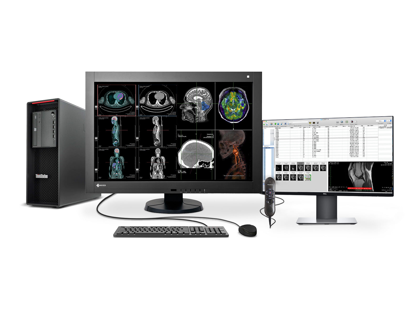 Complete PACS General Radiology Station | Eizo 4MP Color LED Displays | Lenovo Workstation | Dictation Mic | Worklist Monitor (RX440Z4R)