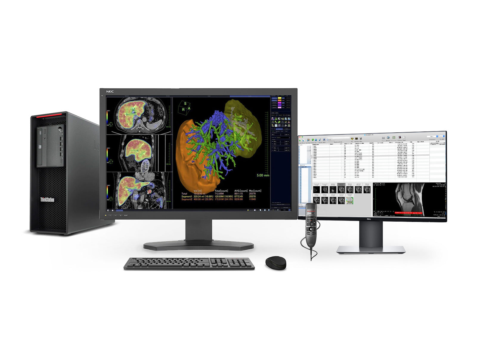 K様線　EIZO RadiForce MX215 医療用 モニター2台セット RadiForce MX215 | EIZO