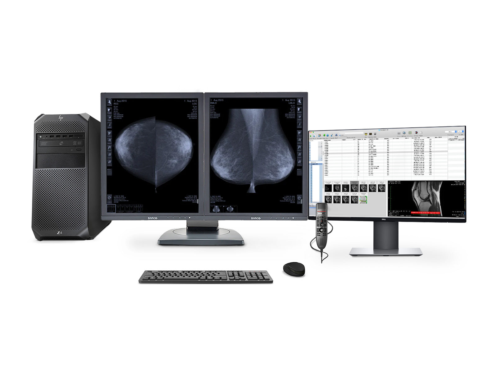 Komplette Mammographie -Lesestation | Barco MDCG-5121 5MP Graustufen 3D-DBT-Anzeigen | HP Workstation | Diktatmikrofon | Work List Monitor (MD5121Z4R)