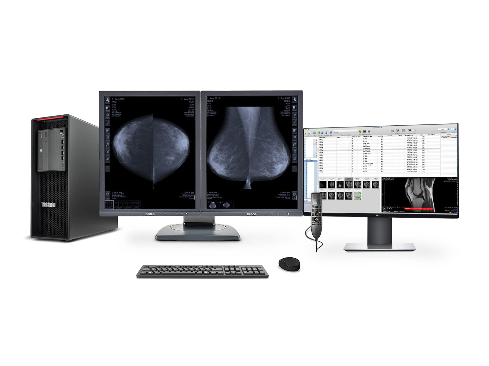 Stazione di lettura mammografica completa | Barco MDCG-5121 5MP Grayscale esposizioni in-3-D-DBT | Lenovo Stazione di lavoro | dettato Mic | monitor di Worklist (MD5121Z4R)