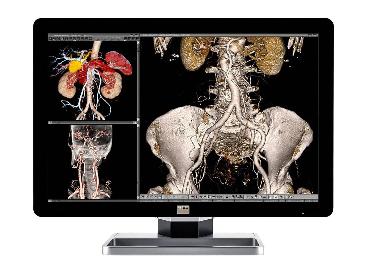 Komplette PACS-Station für allgemeine Radiologie | Barco 4MP Farb-LED-Display | HP-Workstation | Diktiermikrofon | Arbeitslistenmonitor (4330Z2)