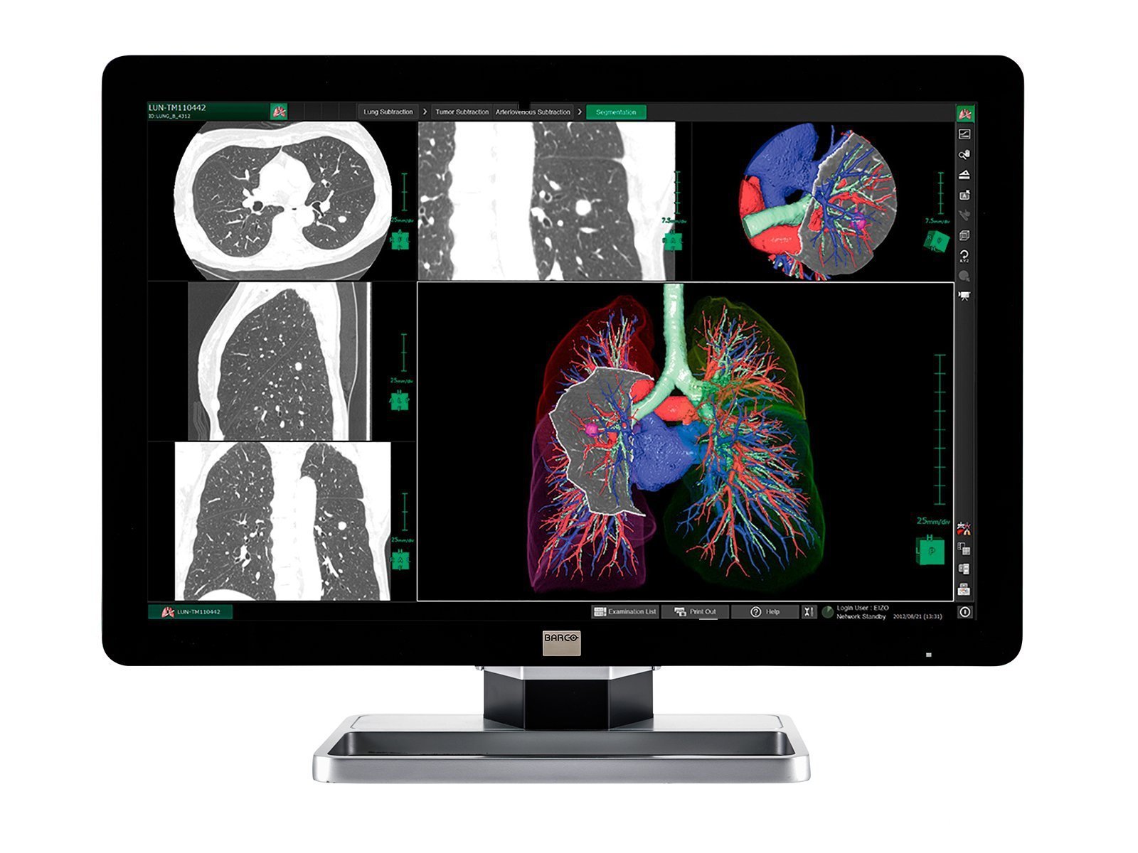 محطة الأشعة العامة PACS كاملة | Barco 6MP شاشة LCD ملونة | Lenovo محطة العمل | ميكروفون الإملاء | شاشة قائمة العمل (6130Z4)