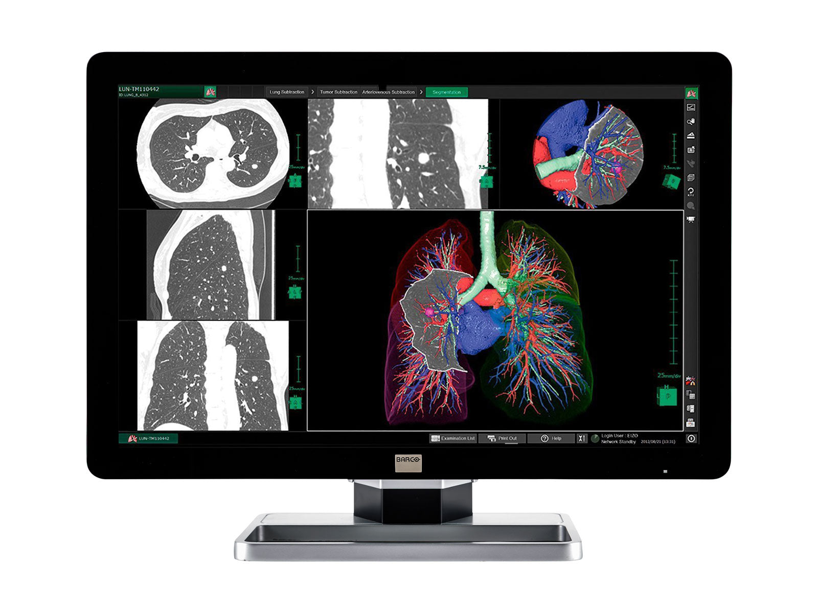 Barco Coronis Fusion MDCC-6330 6MP 30" Écran PACS de radiologie générale LED couleur