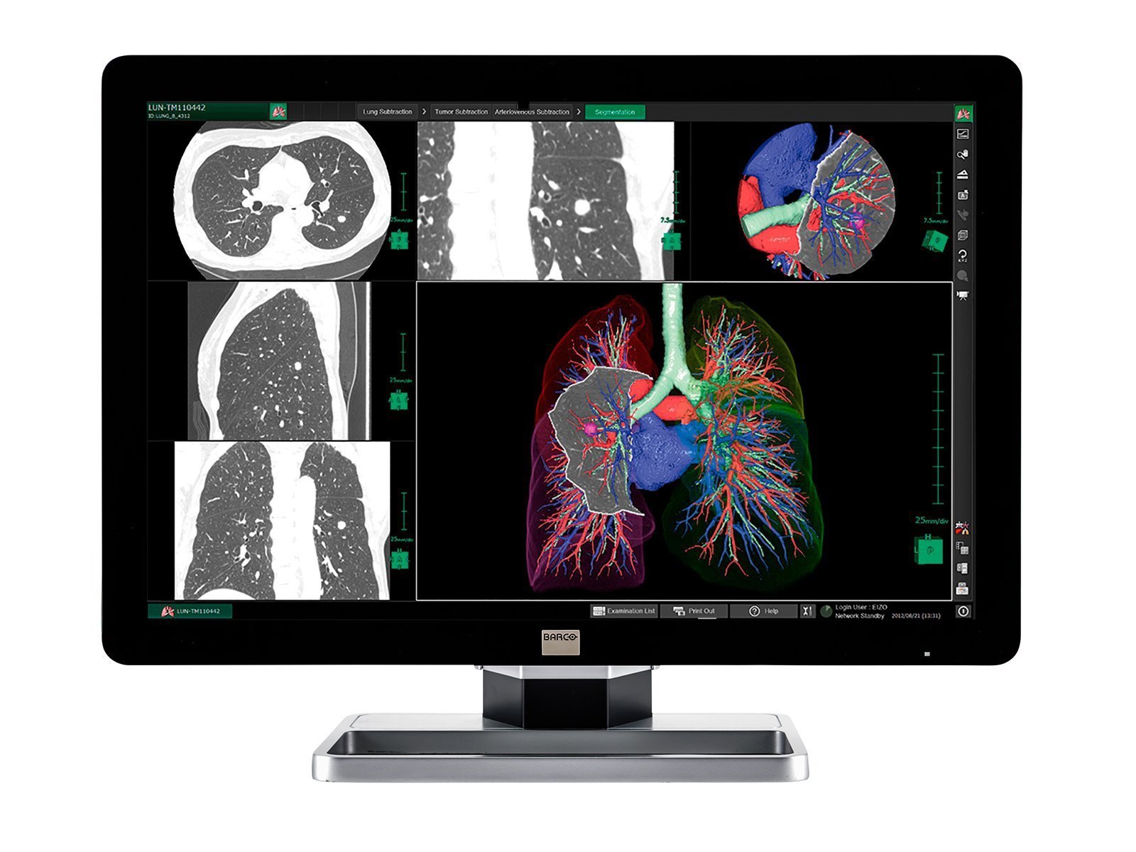 Station complète de radiologie générale PACS | Barco Écran LED couleur 6MP | Poste de travail Dell | Micro de dictée | Moniteur de liste de travail (63307920)