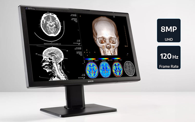 Barco MDPC-8127: Ultra-High Definition Radiology Diagnostic Display
