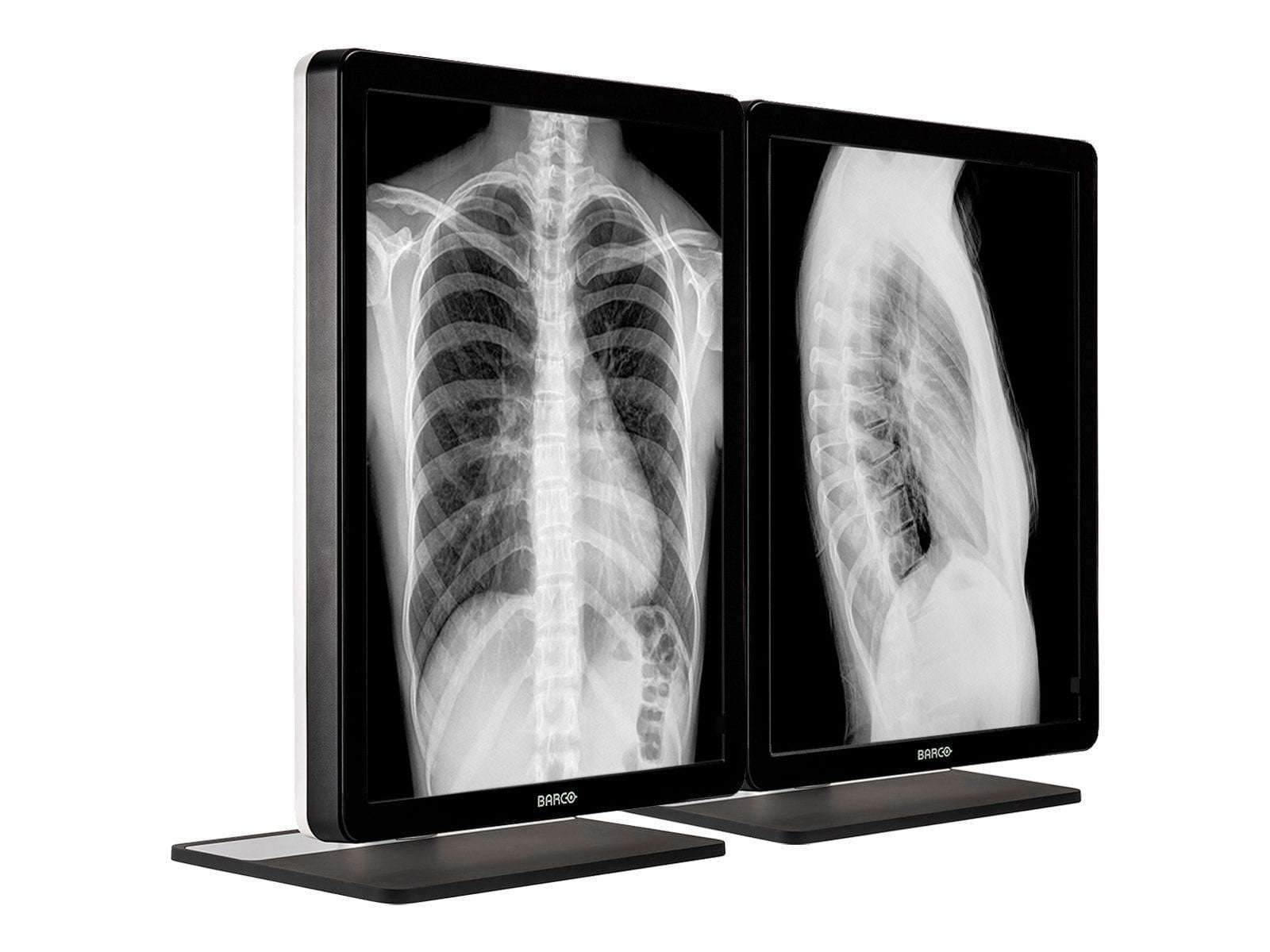 Barco® Coronis MDCG-3221 3MP 21.3" Graustufen-LED-Diagnosedisplay für allgemeine Radiologie (K9301366A)