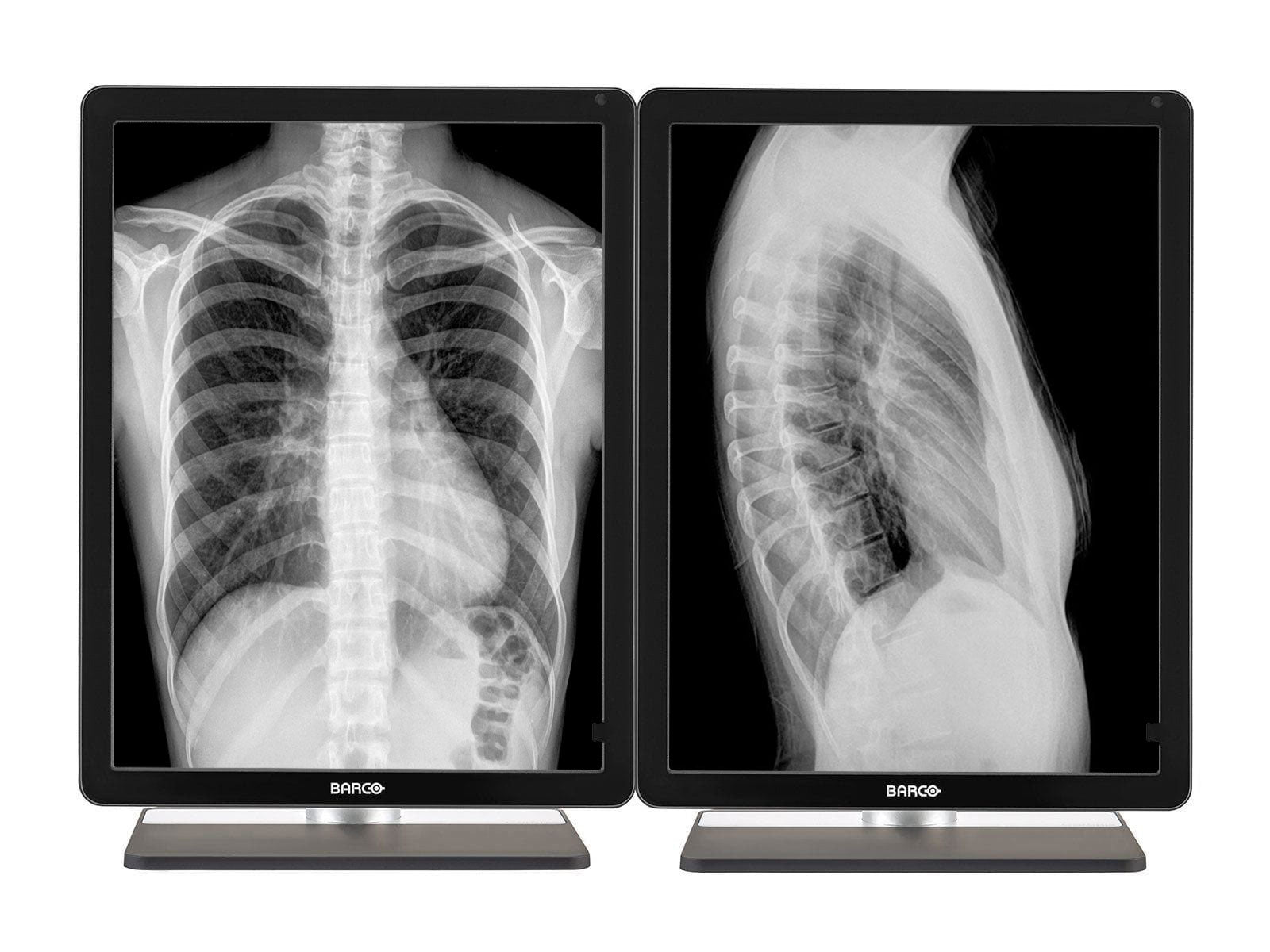 Barco® Coronis MDCG-3221 3MP 21.3" Graustufen-LED-Diagnosedisplay für allgemeine Radiologie (K9301366A)