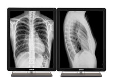 Barco Coronis MDCG-3221 3MP 21" Grayscale LED General Radiology Diagnostic Display