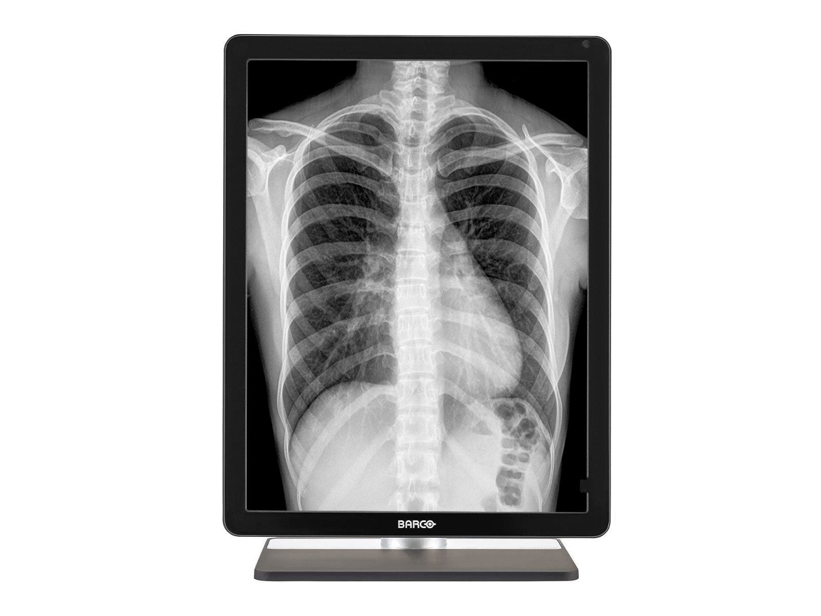 Barco Coronis MDCG-3221 3MP 21" Grayscale LED General Radiology Diagnostic Display Monitors.com 