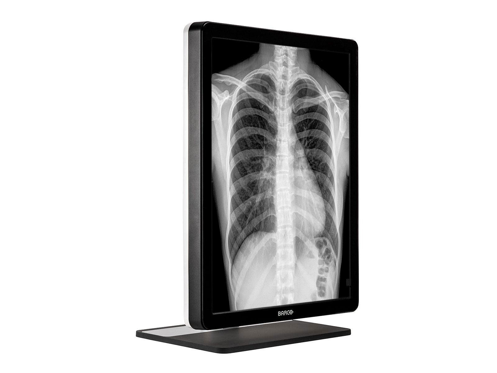 Barco® Coronis MDCG-3221 3MP 21.3" Grayscale LED General Radiology Diagnostic Display (K9301366A)
