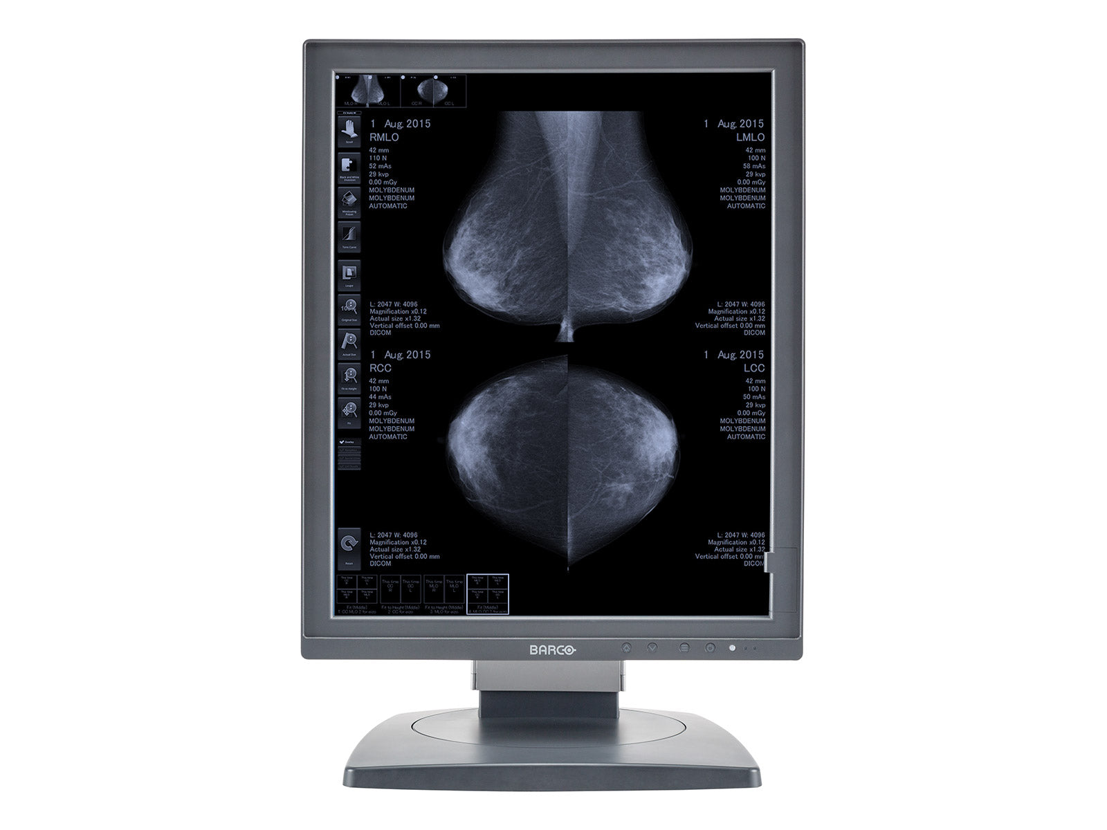 Barco Coronis MDCG-5121 5MP 21" Grayscale Mammo 3D-DBT Breast Imaging Display Monitor