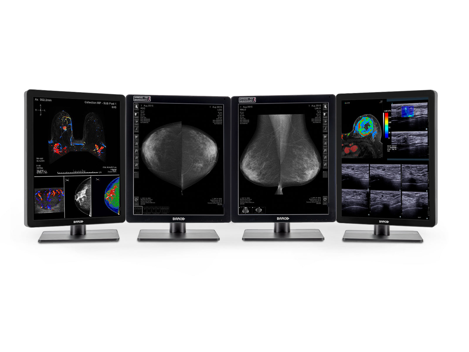 Quad Mammography Reading Setup | Pair (x2) Barco 5MP Grayscale LED Tomo + Pair (x2) Barco 2MP Diagnostic Color Displays (2252MDGC)