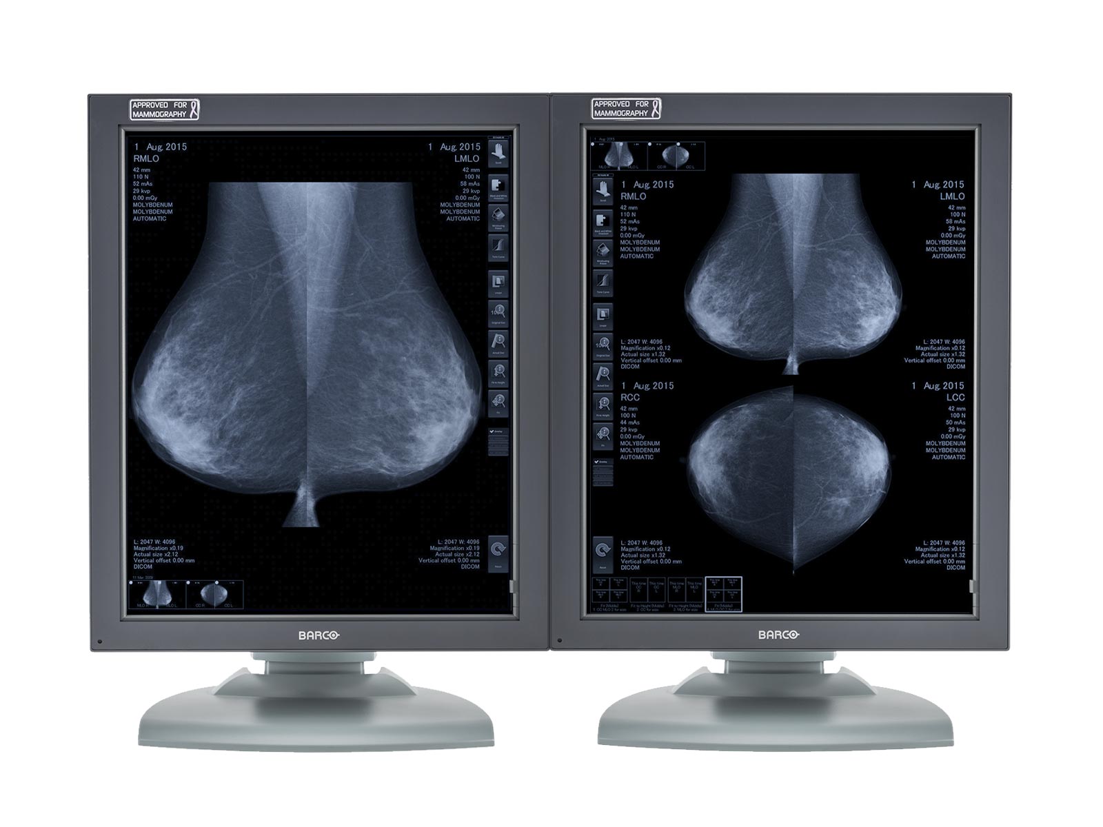 Complete PACS Mammography Reading Station | Barco MDMG-5121 5MP Grayscale Displays | HP Workstation | Dictation Mic | Worklist Monitor (MG5121Z4R)