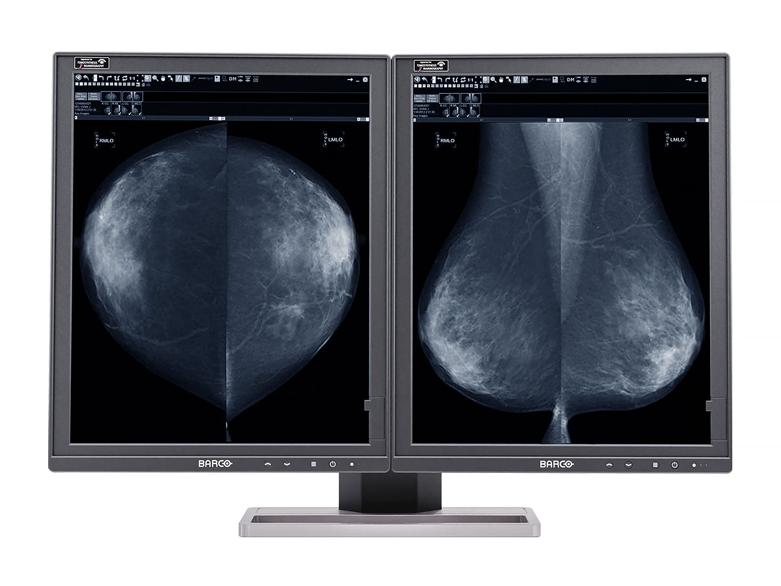 Barco Coronis MDMG-5221 5MP 21" Écran de mammographie LED de tomosynthèse en niveaux de gris 3D-DBT