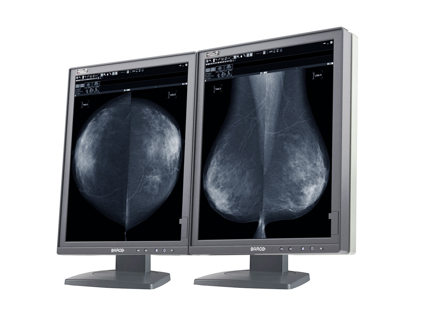 Barco Coronis MDMG-5221 5MP 21" Grayscale Tomosynthesis 3D-DBT Mammography Display