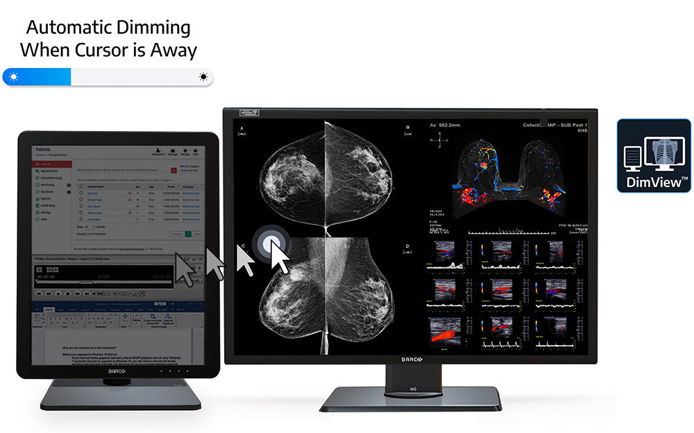 Barco MDNC-12130: Advanced 12MP Mammography Display
