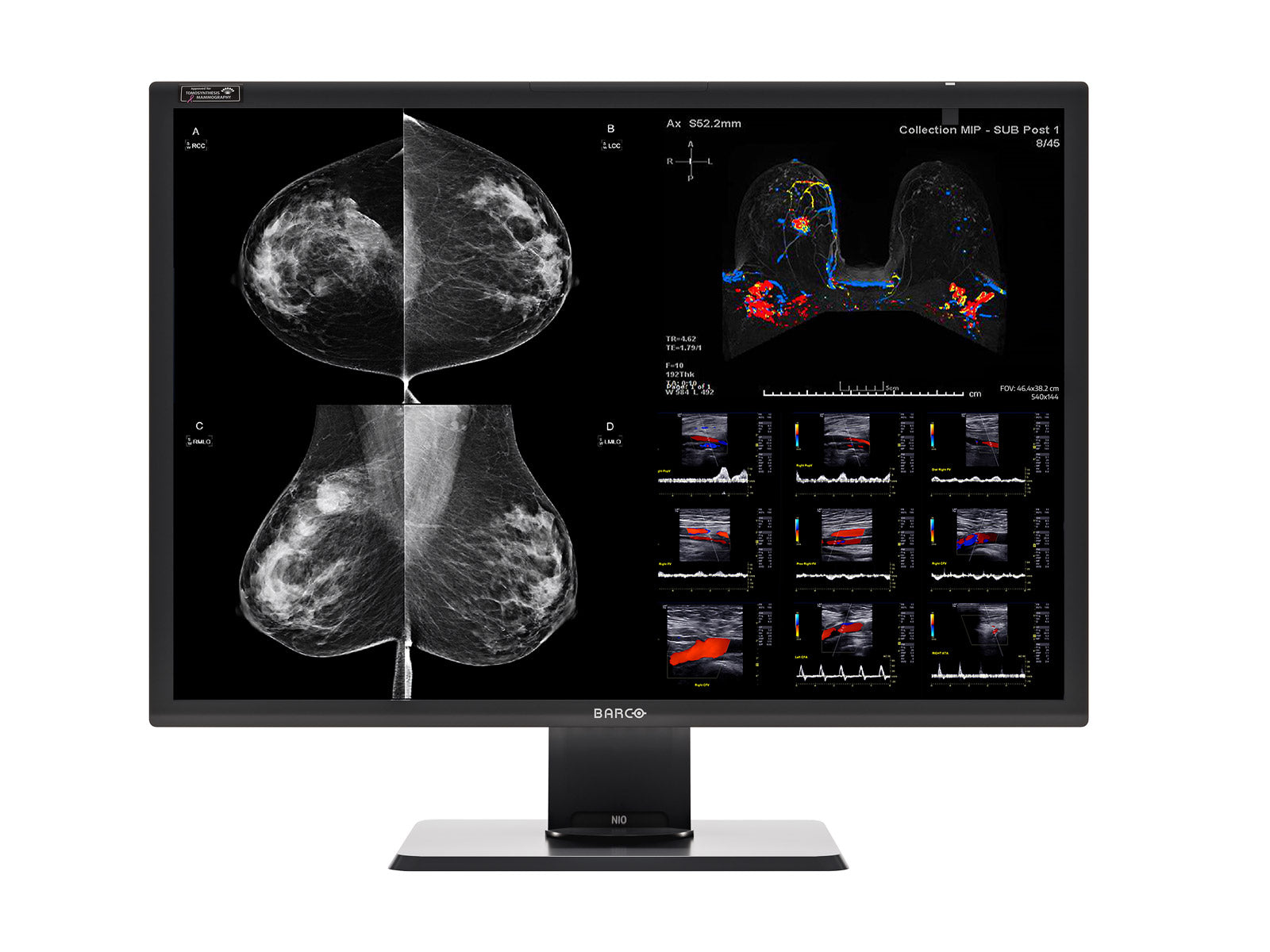 Complete Mammography Reading Station | Barco Nio MDNC-12130 12MP Color | HP Z4 G5 Workstation | Dictation Mic | Worklist Monitors (12130Z4G5)