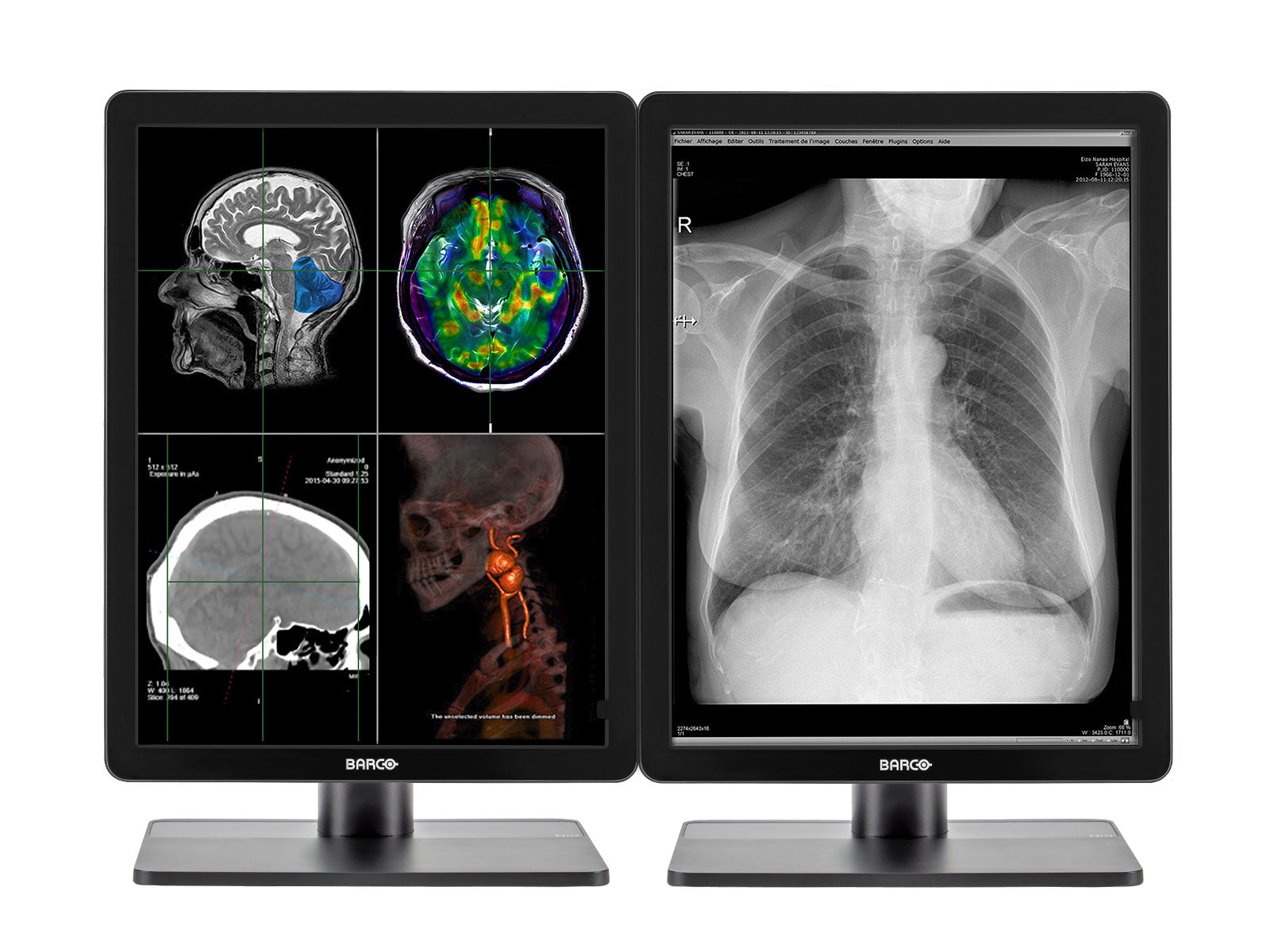 Complete PACS General Radiology Station | Barco Nio 2MP Color LED Display | HP Workstation | Dictation Mic | Worklist Monitor (2221Z2N) Monitors.com 