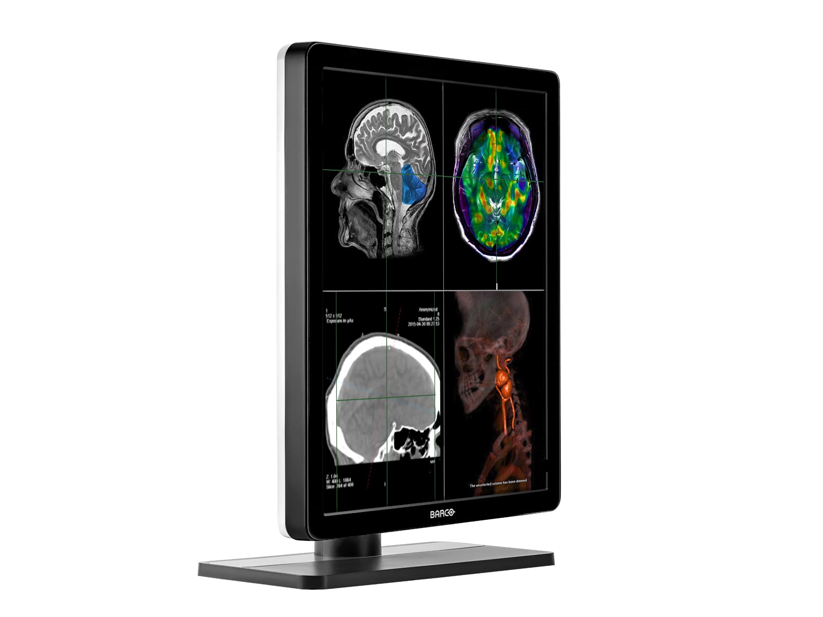 Barco Nio MDNC-2221 2MP 21" Farb-LED-Diagnose-Radiologie-Display-Monitor (K9301648B) Monitors.com