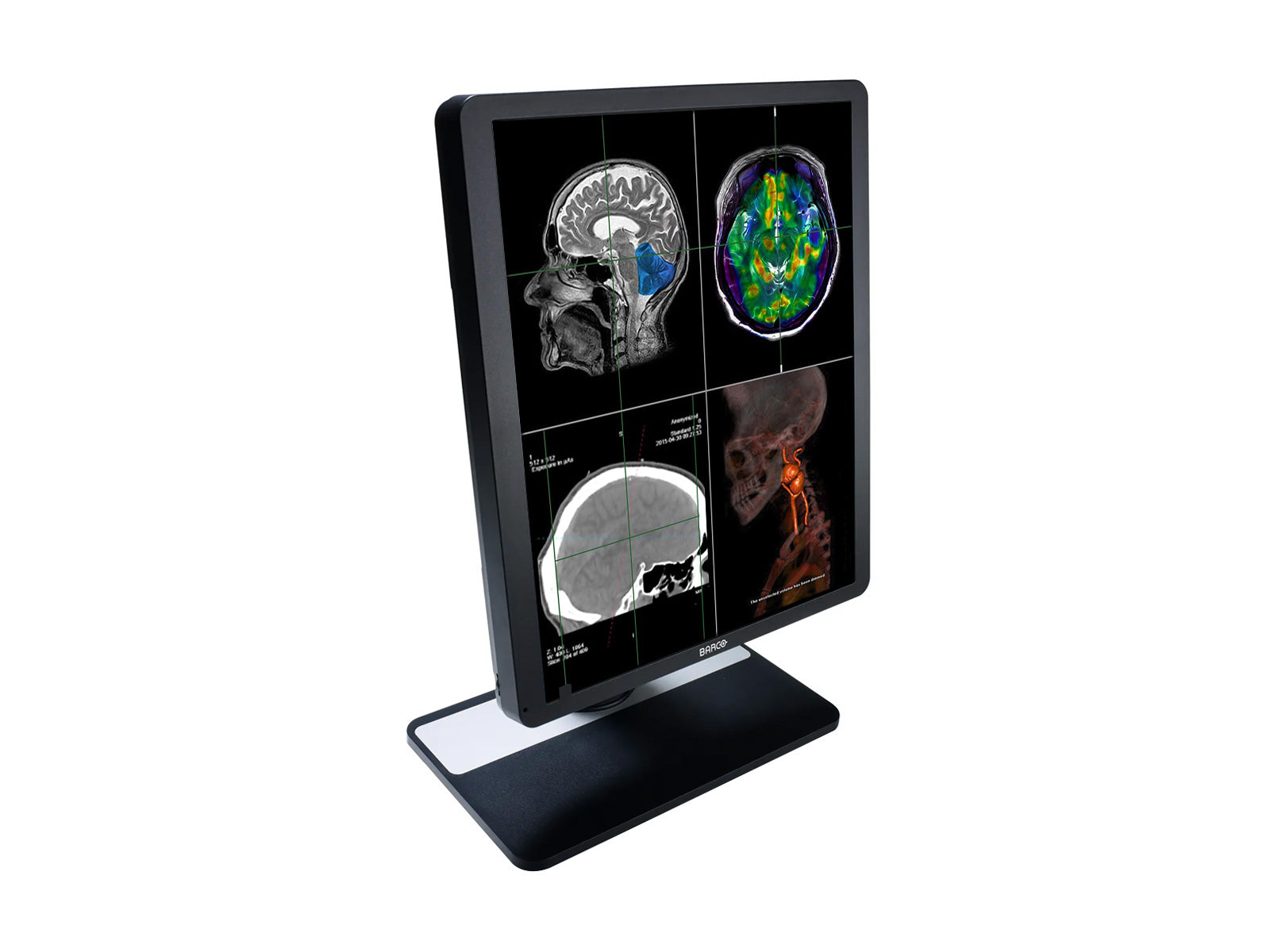 Barco Eonis MDRC-1419 SNIB 1MP 19" Color LED Clinical Review Display Monitor