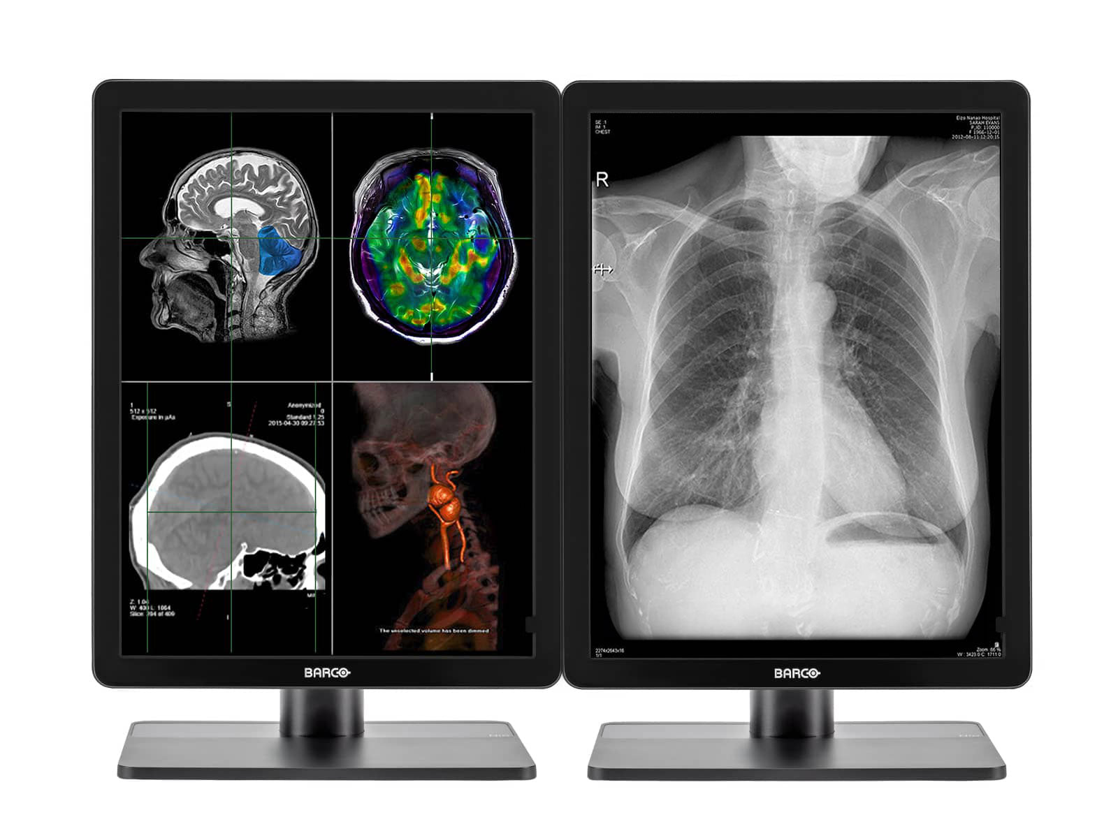 Barco Nio MDNC-3321 Pantalla PACS de diagnóstico de radiología general LED a color de 3MP y 21"