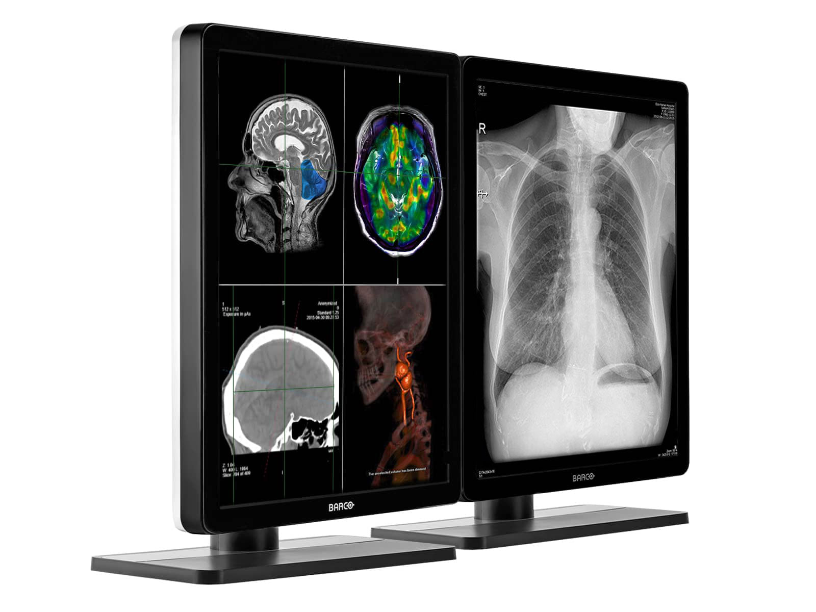 Barco Nio MDNC-3321 3MP 21" Color LED General Radiology Diagnostic PACS Display Monitors.com 