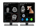 Coppia (x2) Barco Nio MDNC-3421 3MP con Monitor a colori per radiologia generale da 21