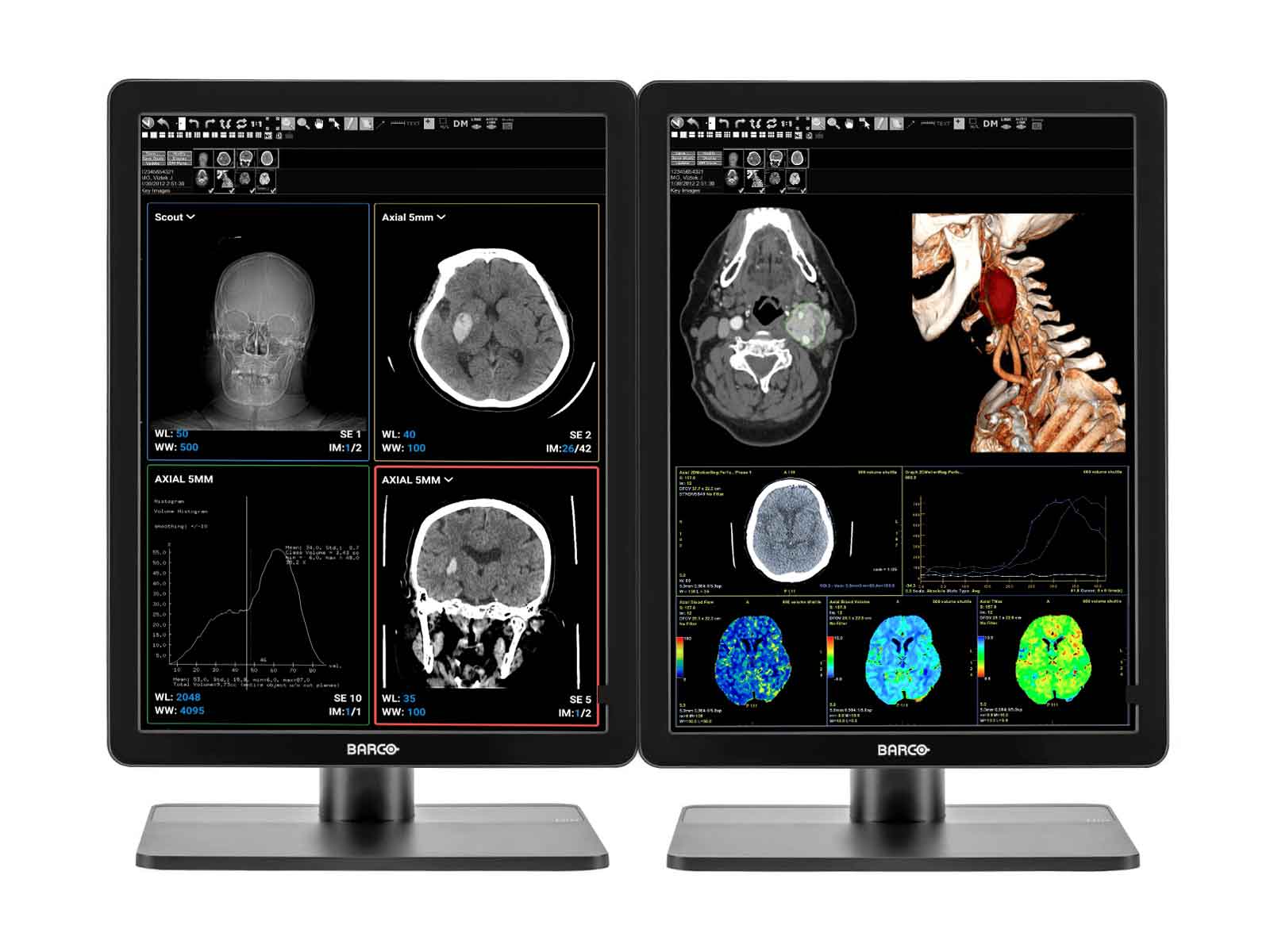 Barco Nio MDNC-3421 3MP 21.3" Farb-LED-PACS-Display für allgemeine Radiologie