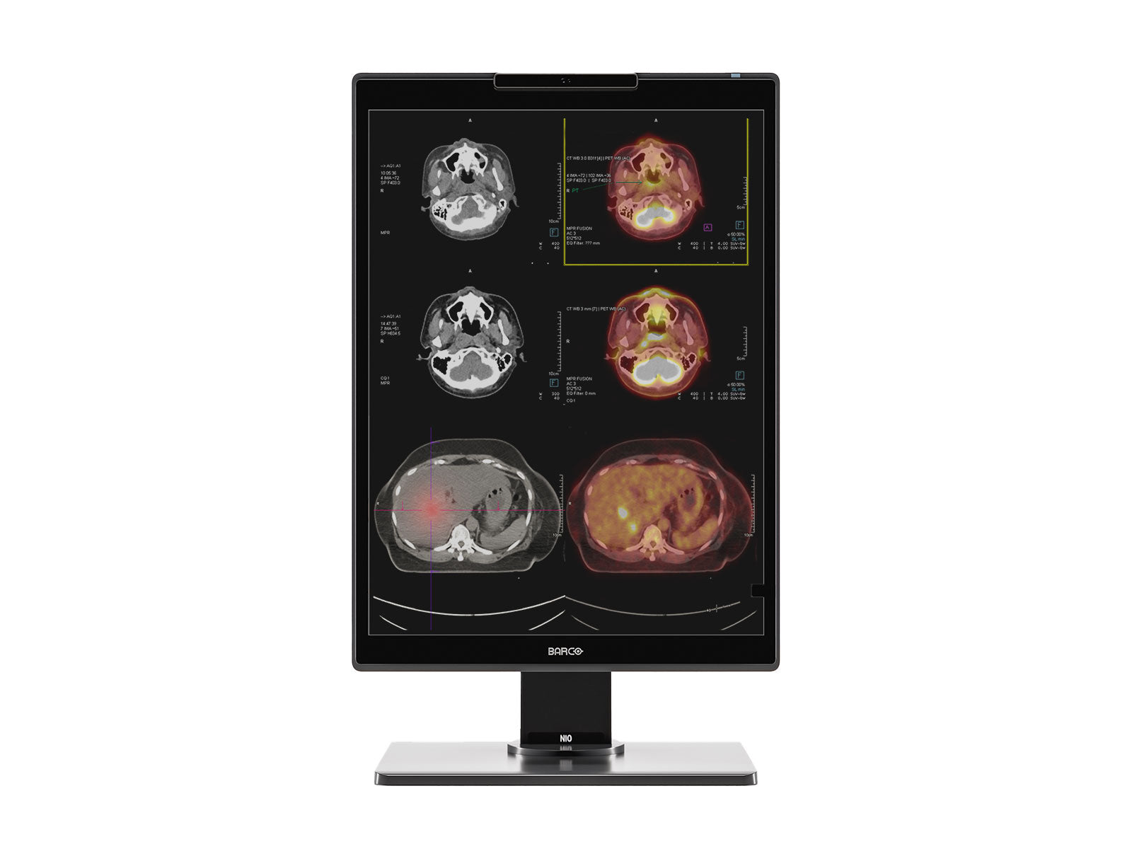 Barco Nio MDNC-3521 Monitor de pantalla de radiología de diagnóstico LED en color de 3MP y 21" (K9300390A)