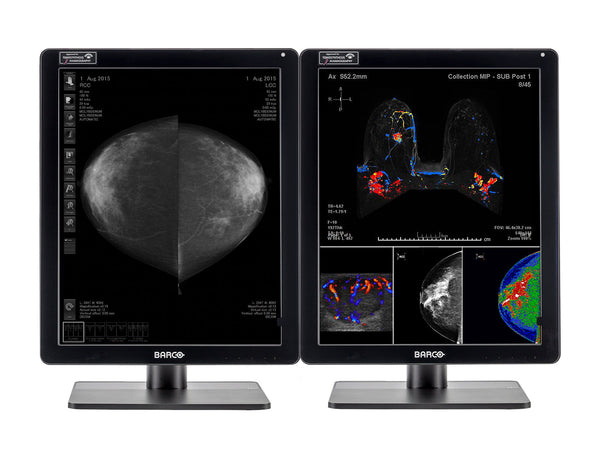 Complete Mammography Reading Station | Barco 5MP MDNC-6121 Color LED Monitors | HP Z4 G5 Workstation | Dictation Mic | Worklist Monitors (61212221)