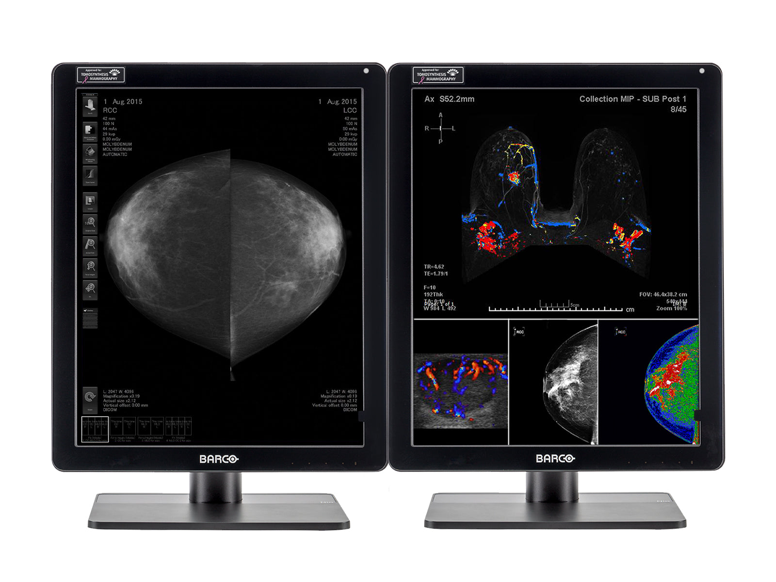 Komplette Mammographie-Lesestation | Barco 5MP Farb-LED-Monitor | HP-Workstation | Diktiermikrofon (LFH3510)| Arbeitslistenmonitore (61212321R)