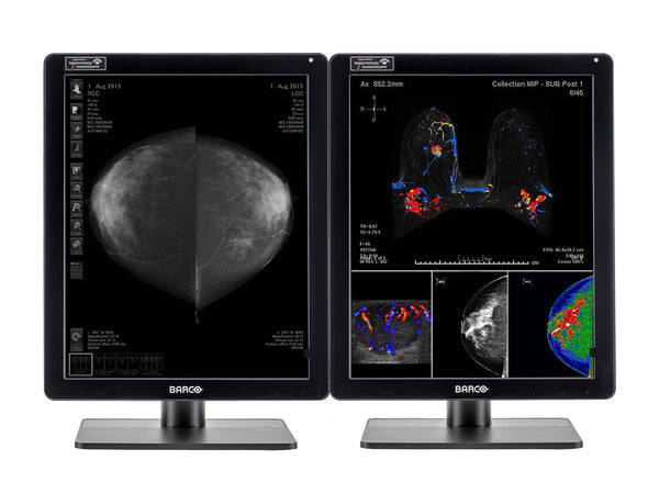Complete Mammography Reading Station | Barco 5MP MDNC-6121 Color LED Monitors | HP Workstation | Dictation Microphone (LFH3510)| Worklist Monitors (61212321R)