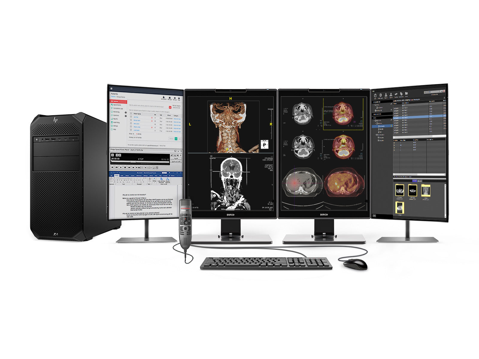 Color Led General Radiology Complete PACS General Radiology Station | Barco 3MP Color LED MDNC-352