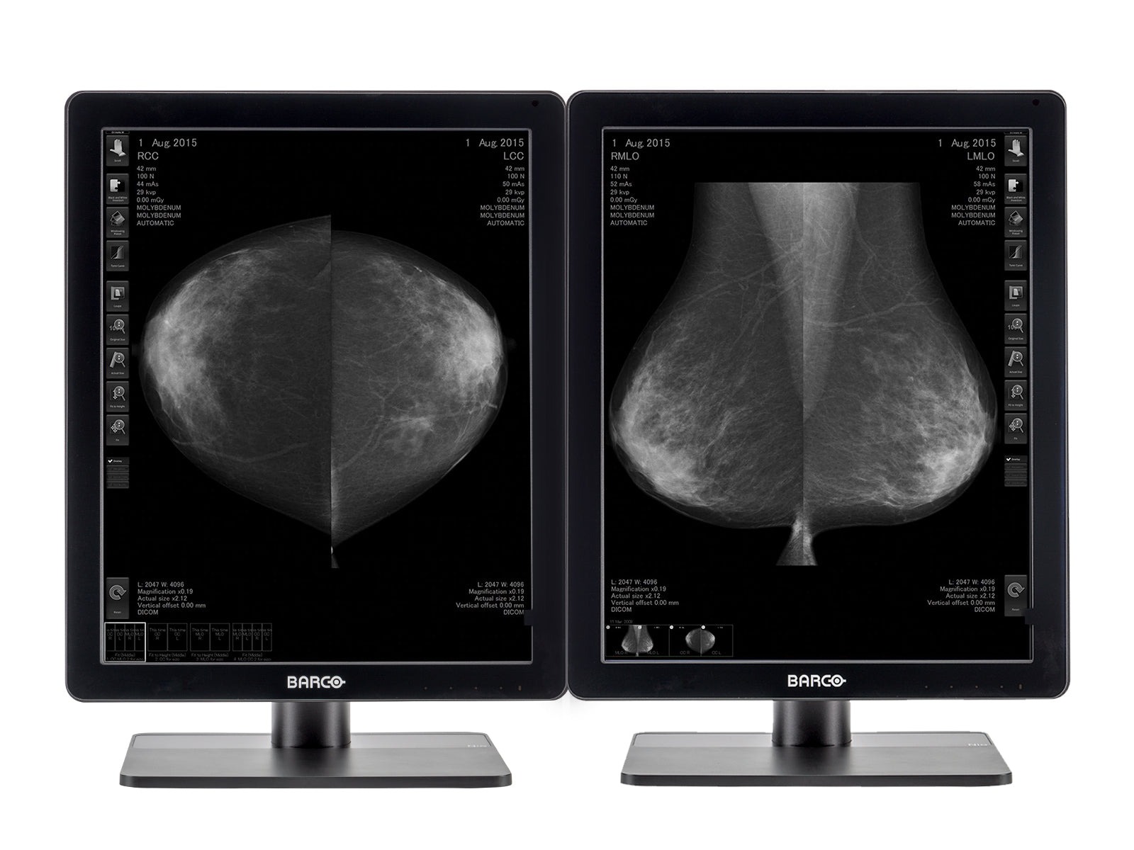 Estación completa de lectura de mamografía | Barco Escala de grises de 5 MP | Estación de trabajo HP (5221Z6R) Monitors.com