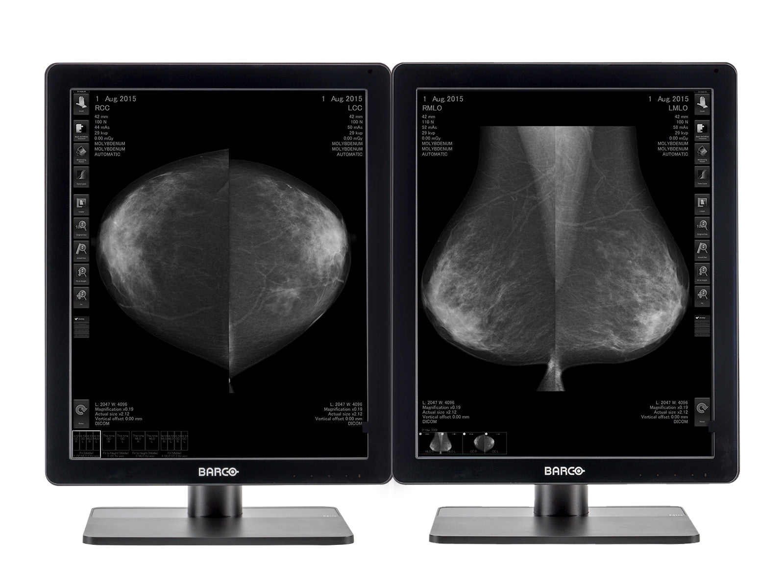 Complete Mammography Reading Station | Barco 5MP Grayscale LED Monitor | Dell Workstation | Dictation Mic | Worklist Monitor (5221Z24X) Monitors.com 