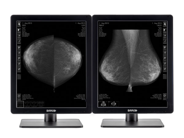 Complete Mammography Reading Station | Barco MDNG-5221 5MP Grayscale LED Monitors | HP Workstation | Dictation Mic | Worklist Monitor (5221Z4R)