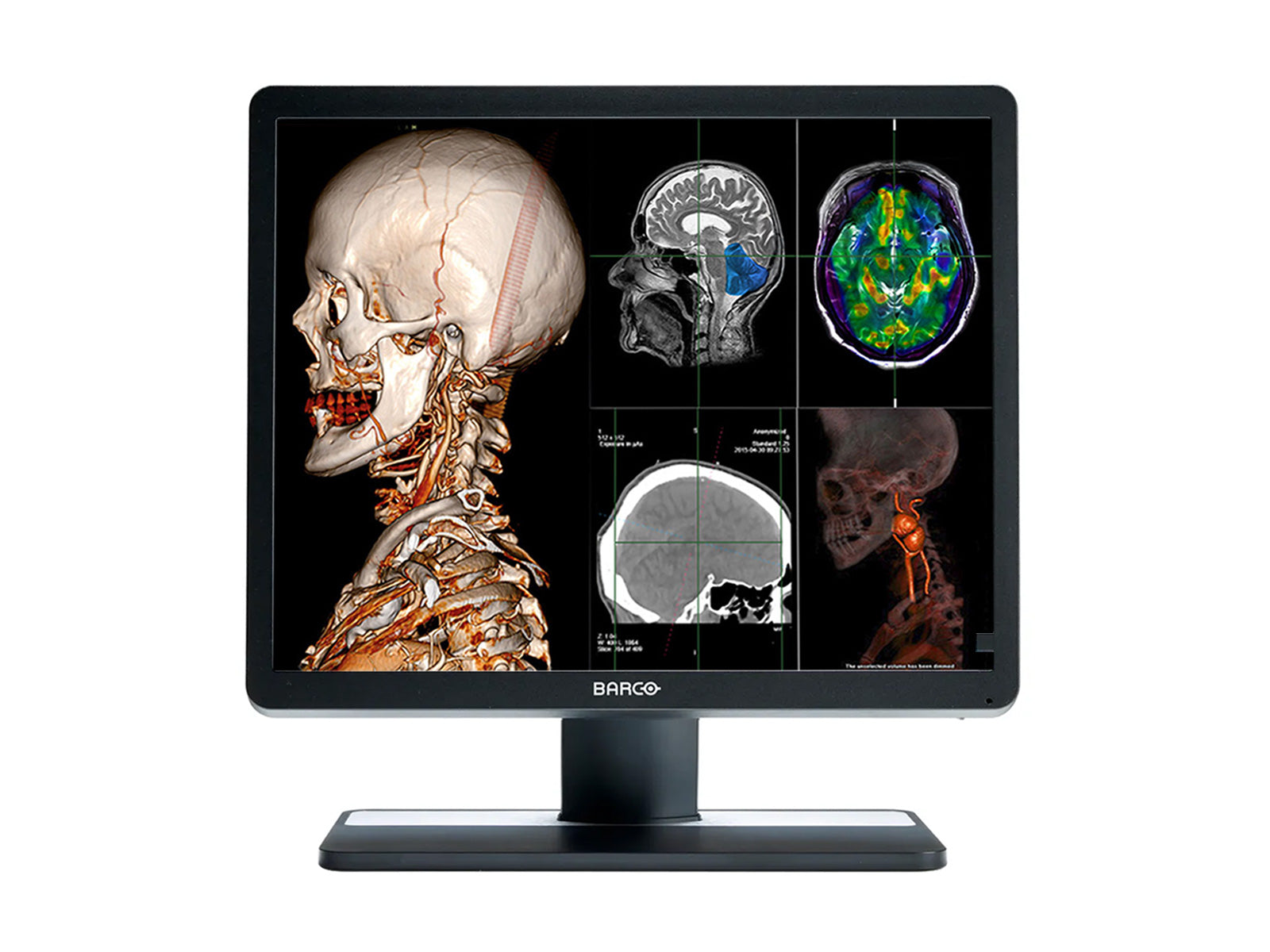 Barco Eonis MDRC-1419: Monitor Clínico LED de 19"